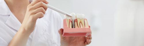 Mid section closeup of smiling female dentist holding tooth model while consulting patient in clinic, copy space